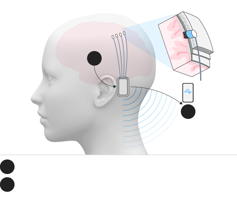 neuralink
